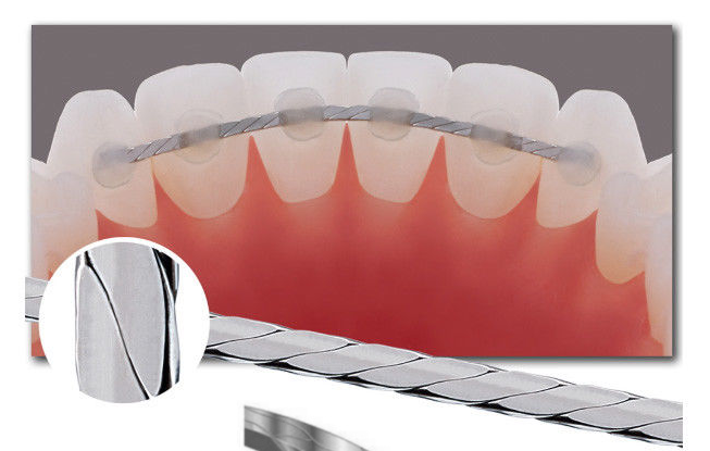 Dentaurum flat retainer wire | DentaCarts | Dental Cart