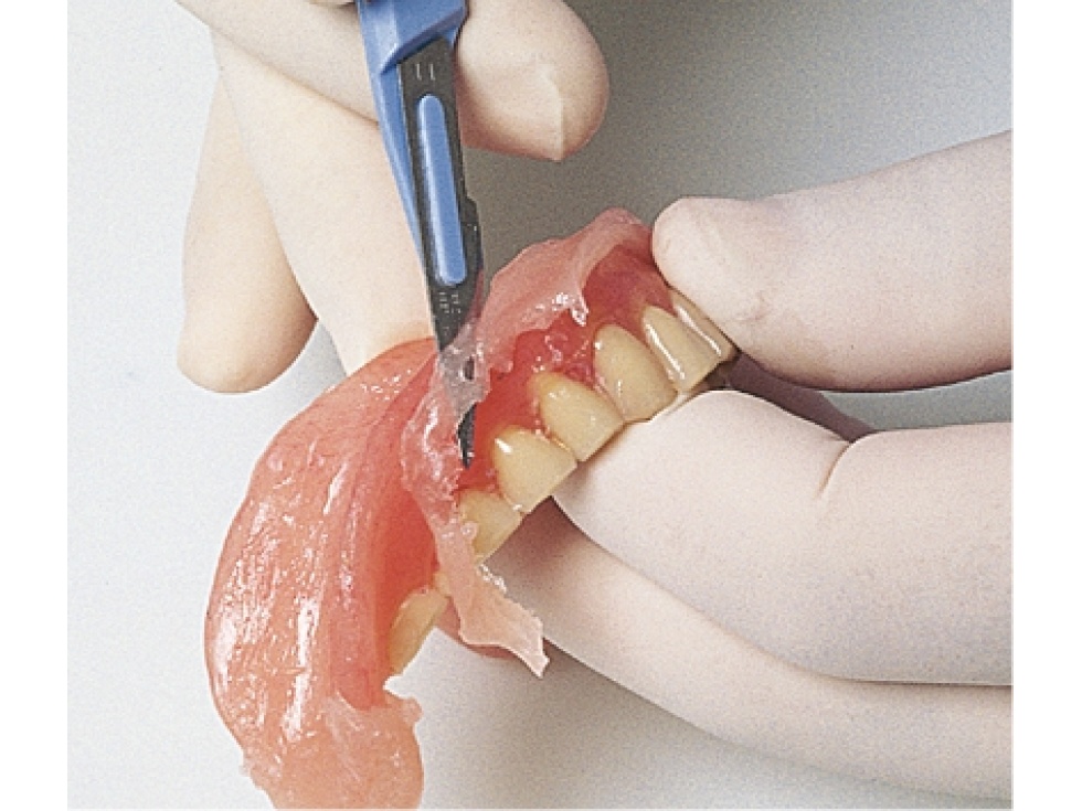 Detax Mollosil Plus | DentaCarts | Dental Cart