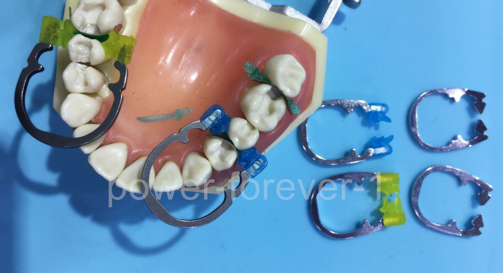 ZT Dental NiTi Ring with Wedge-Shaped Tips | DentaCarts | Dental Cart