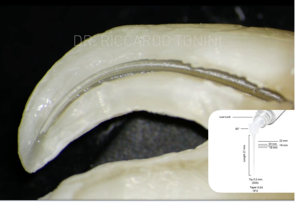 PD IrriFlex | DentaCarts | Dental Cart