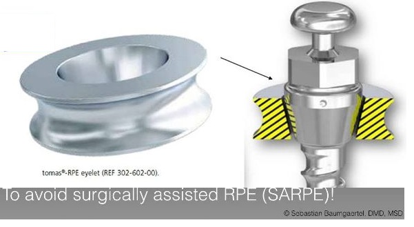 tomas RPE eyelet for MARPE Dentaurum | DentaCarts | Dental Cart