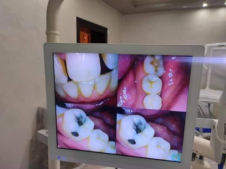 Jeep intraOral Camera with out scren | DentaCarts | Dental Cart