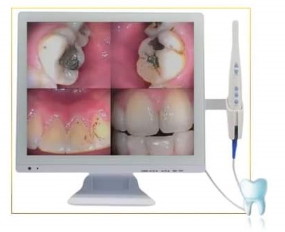 Jeep intraOral Camera with out scren | DentaCarts | Dental Cart