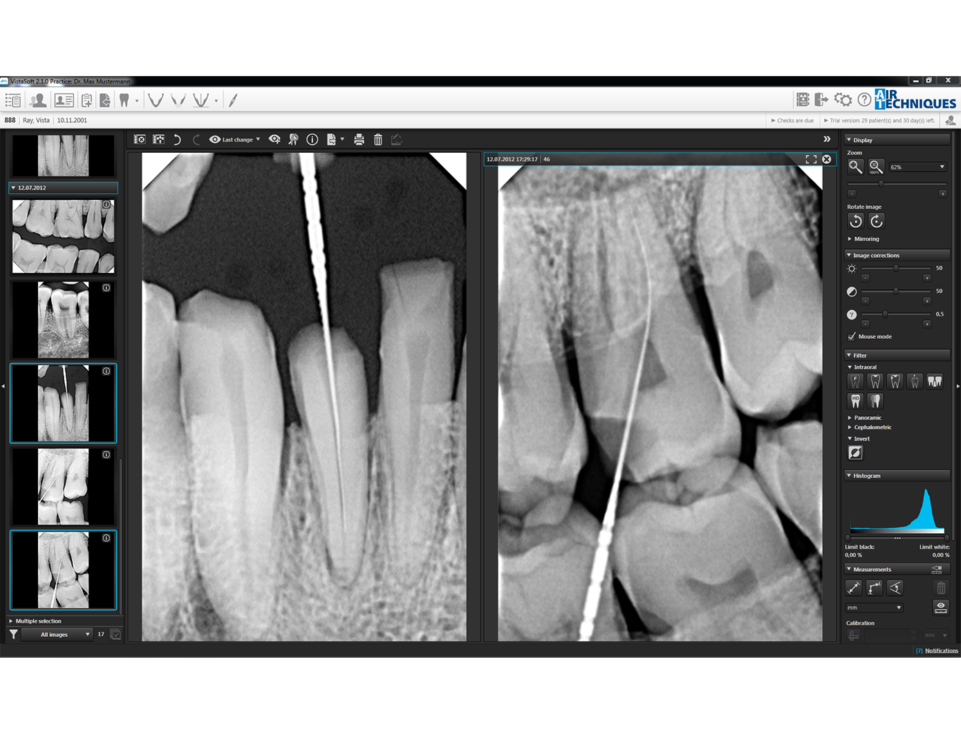 Airtechniques sensor X | DentaCarts | Dental Cart
