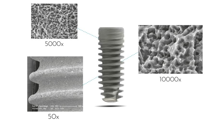 BIL implant  Package  (​Buy 30 implant 55500 instead 63500) | DentaCarts | Dental Cart