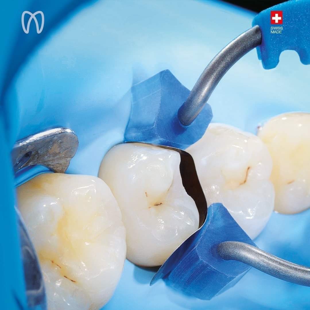 Classico Ring | DentaCarts | Dental Cart