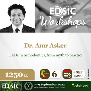 TADs in orthodontics, from myth to practice | DentaCarts | Dental Cart