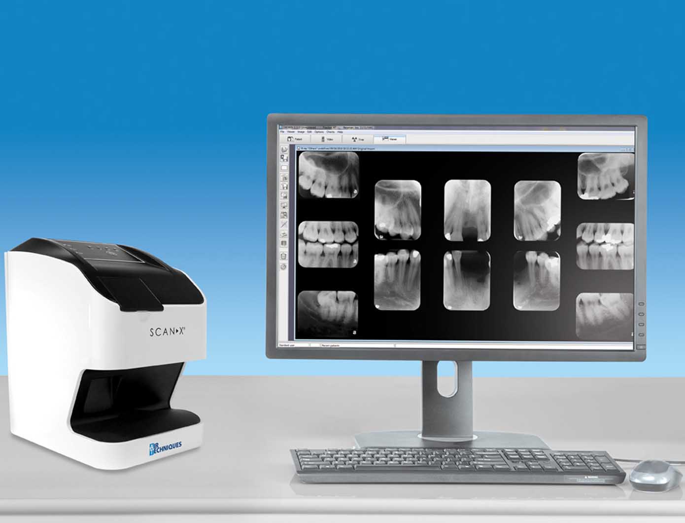 Air Techniques ScanX Edge | DentaCarts | Dental Cart