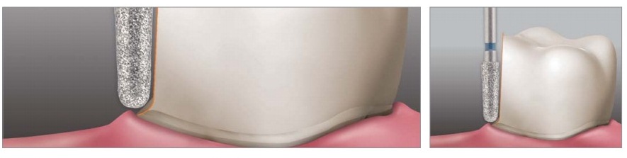 APPLEDENTAL Diamond Burs 10pcs | DentaCarts | Dental Cart