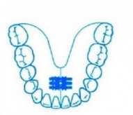 Leone Universal Screw 2-Way | DentaCarts | Dental Cart