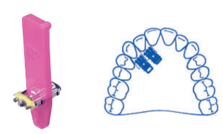 Leone Super Micro Screw 1-Way 3mm | DentaCarts | Dental Cart