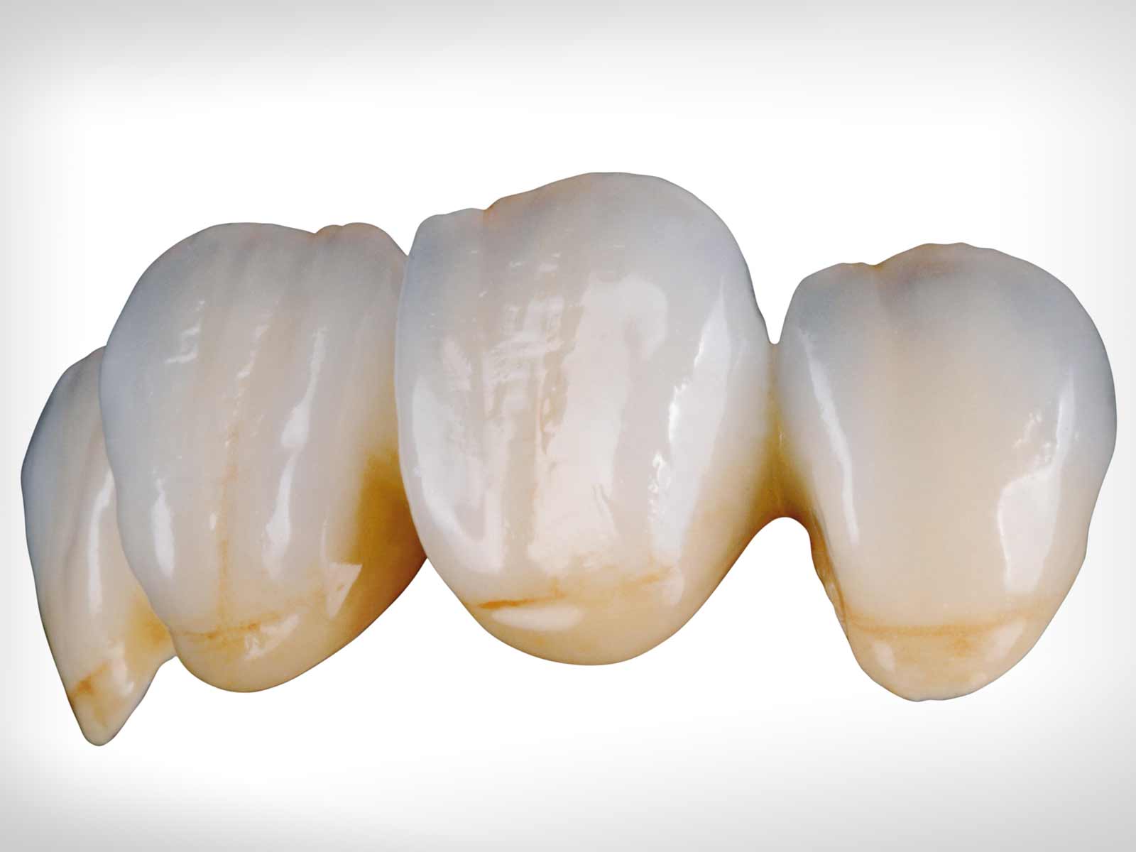 Dentaurum ceraMotion One Touch No Limits Set | DentaCarts | Dental Cart