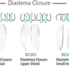 Bioclear Diastema Closure Matrix | DentaCarts | Dental Cart