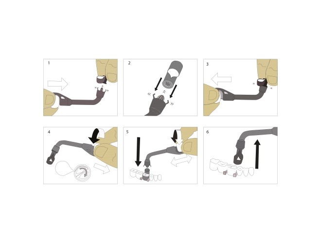Dentac Easy Retainer | DentaCarts | Dental Cart