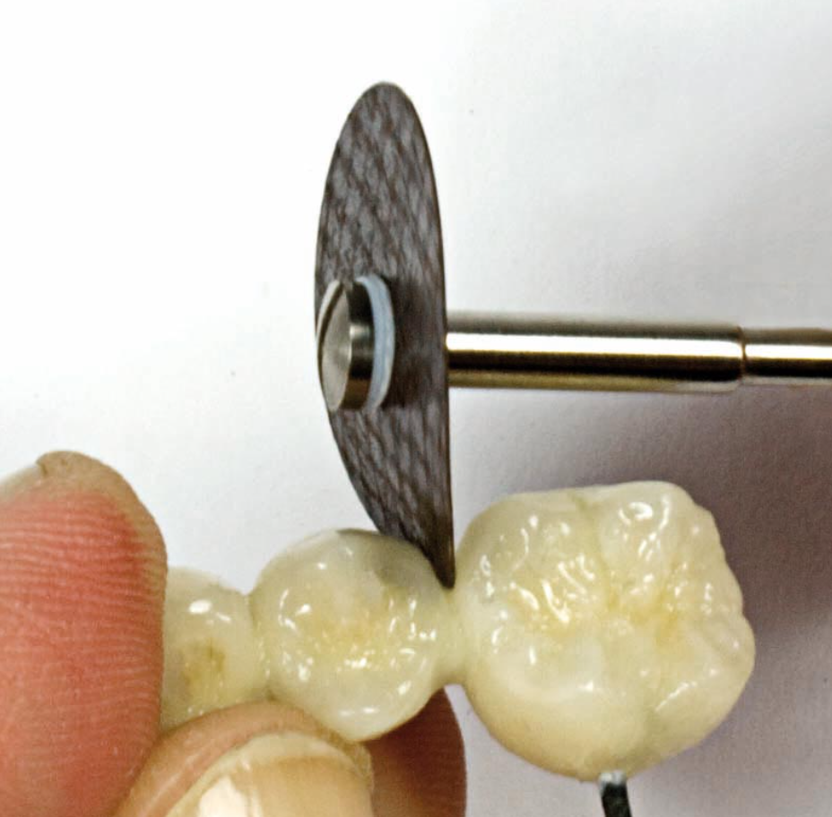 Yeti MAGIC DISC | DentaCarts | Dental Cart