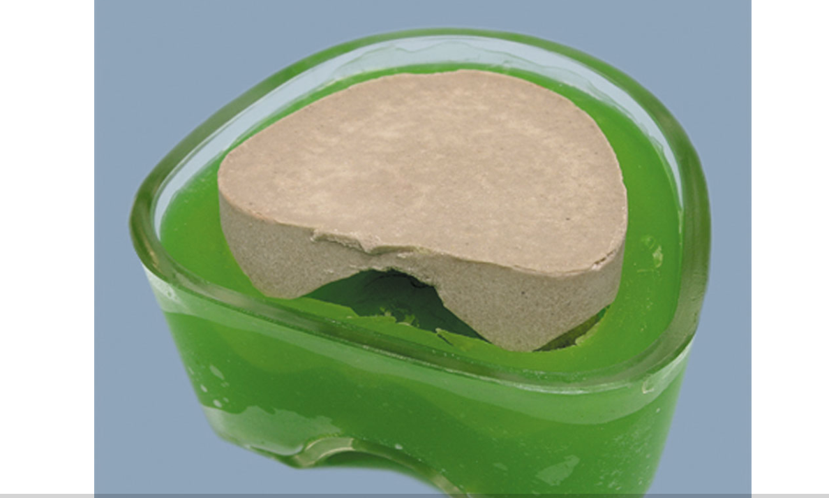 YETI PRECIGEL duplicating gel green 6KG | DentaCarts | Dental Cart