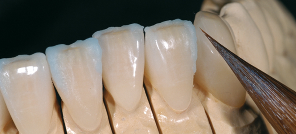 Smile Line Holding Gel | DentaCarts | Dental Cart