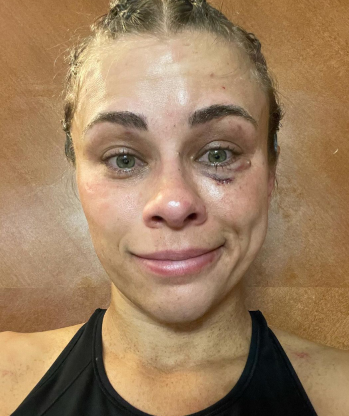 Paige VanZant after her BKFC loss