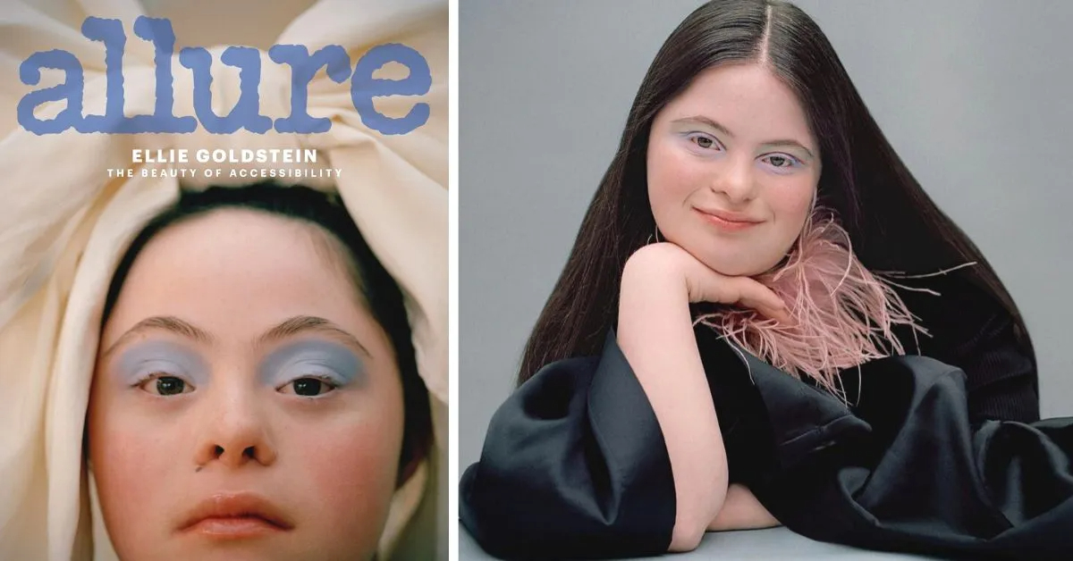 Model With Down Syndrome Lands Allure Magazine Cover