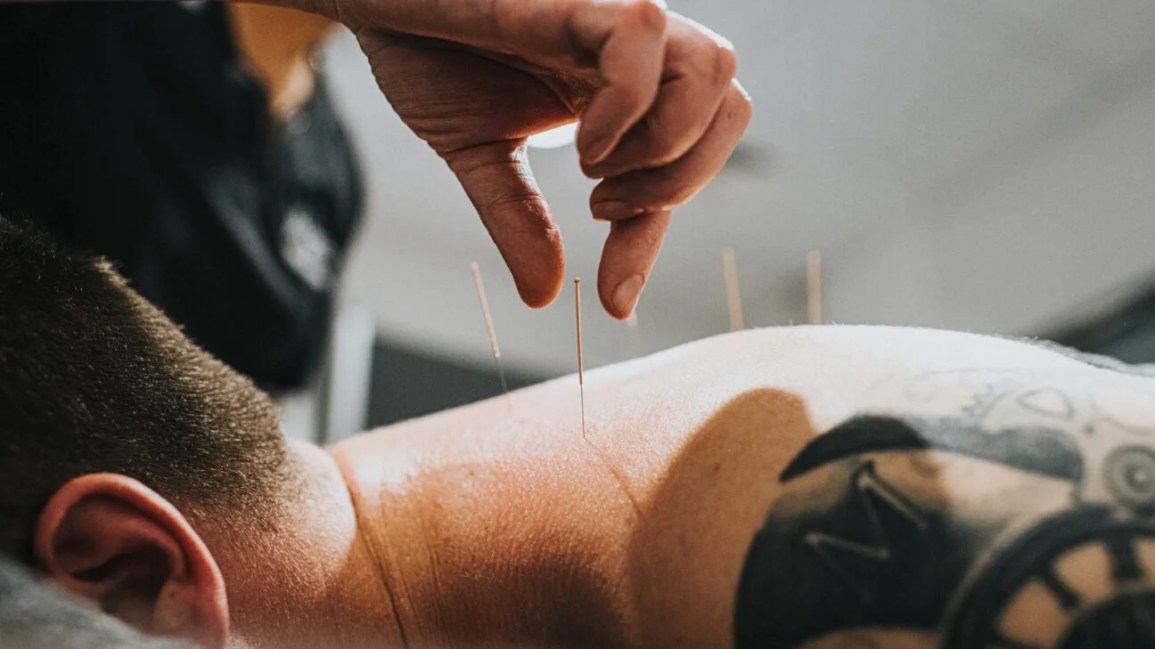 acupuncture needles and blood pressure monitor