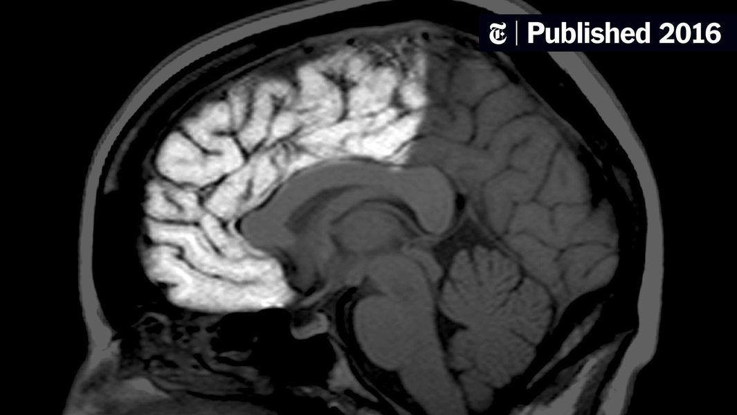 adolescent-brain-development-behavior-w78yu3yf