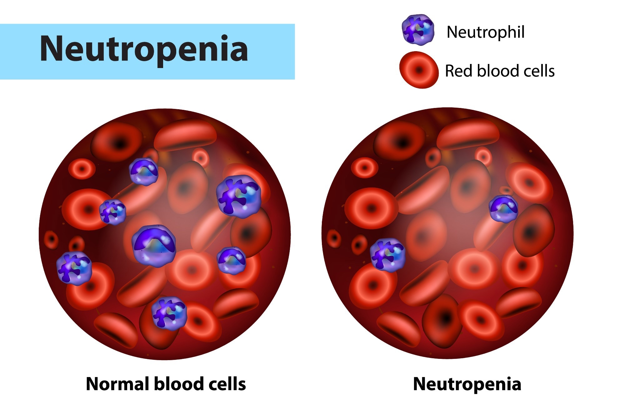 neutrophil count medical laboratory