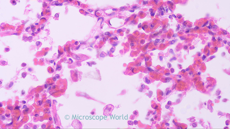 lung microscopy bacteria