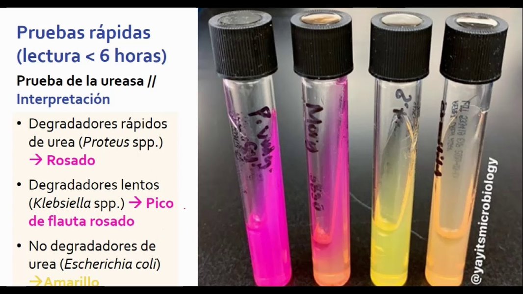 Imagen ilustrativa de pruebas bioquímicas como ureasa e indol