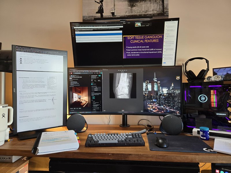 Optimized Anki study setup