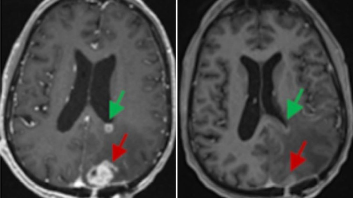 brain scans, infusion treatments, medical research laboratory