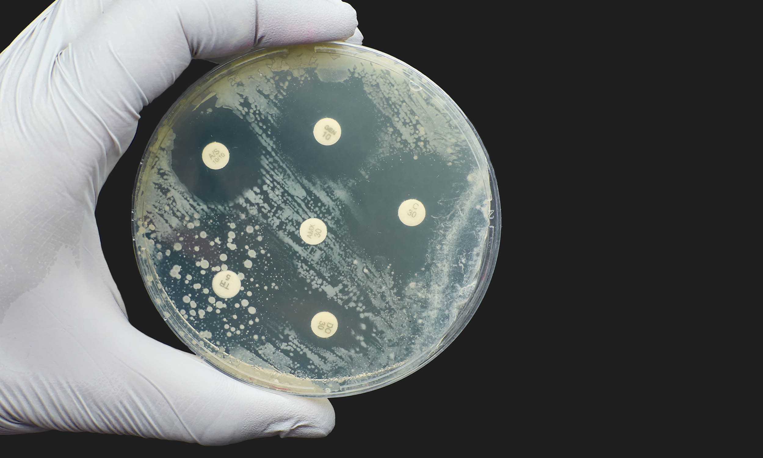 laboratory experiment antimicrobial testing