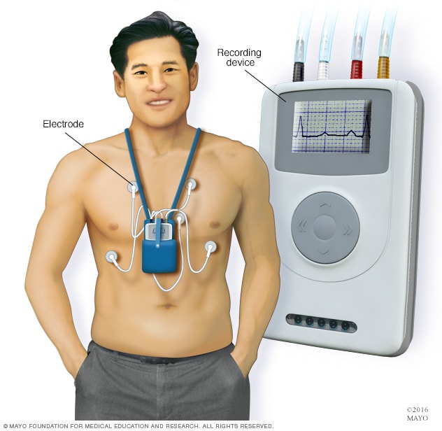 cardiac monitoring device with medical equipment