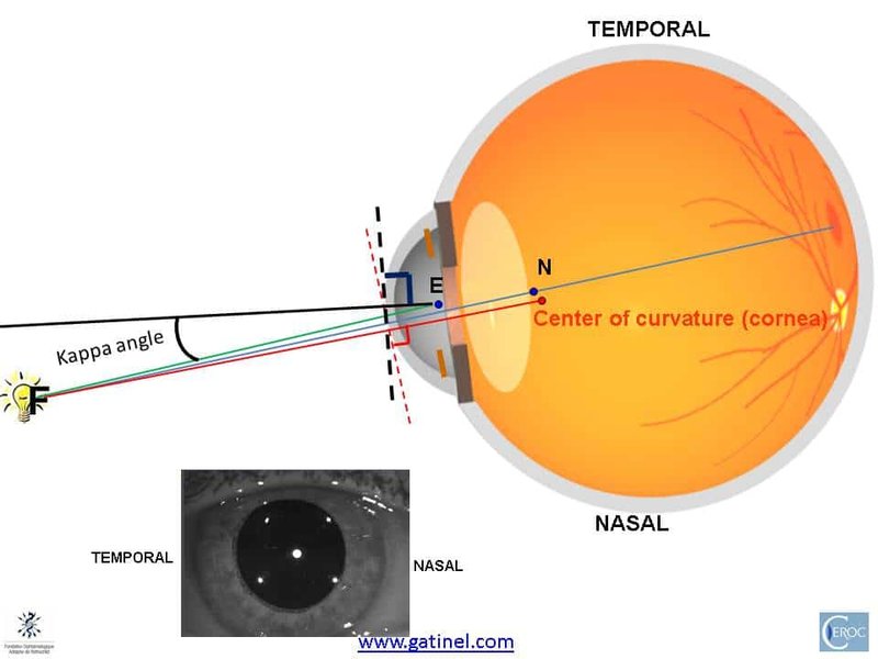 average-angle-kappa-optical-visual-axis-lwcsvae7