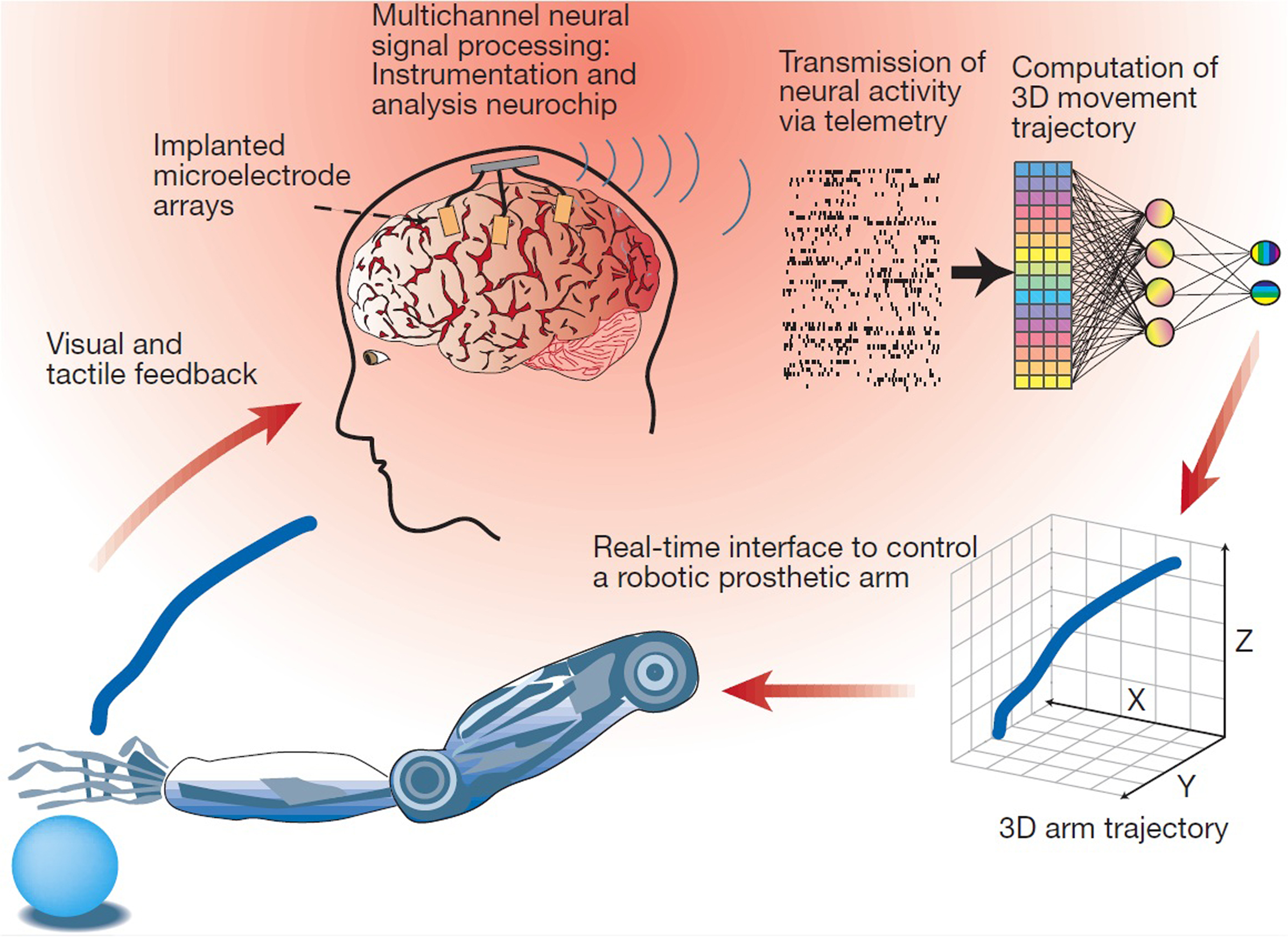 brain computer interface prosthetics communication