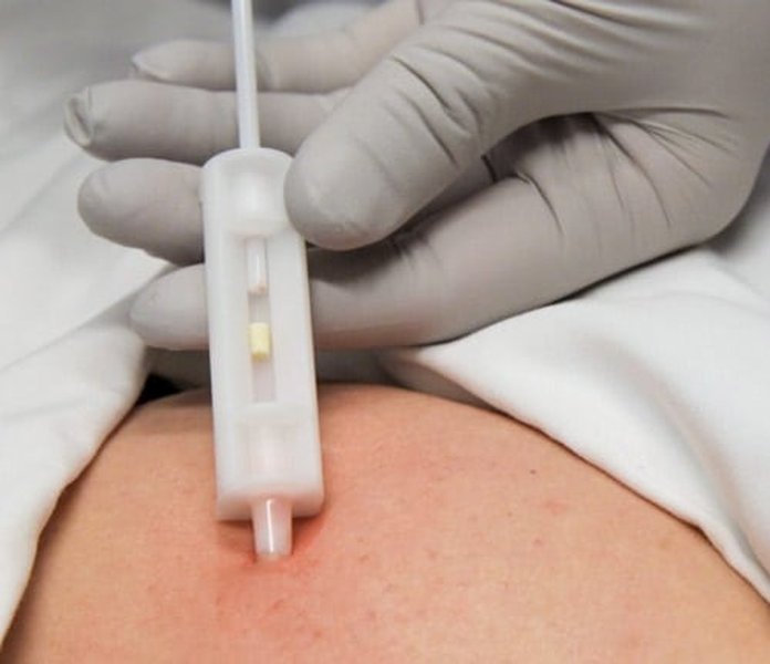 biote-low-t-benefits-risks-lj48xnvd