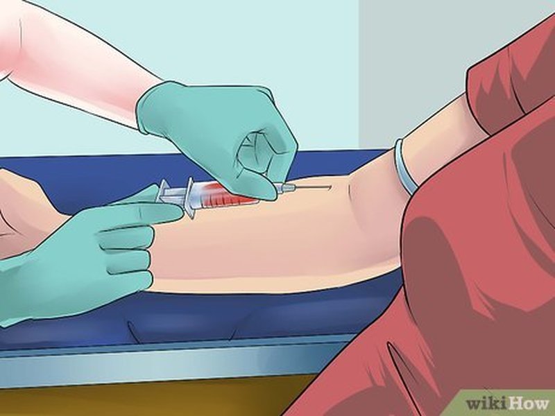 blood-test-preparation-comprehensive-guide-cw85oa5j
