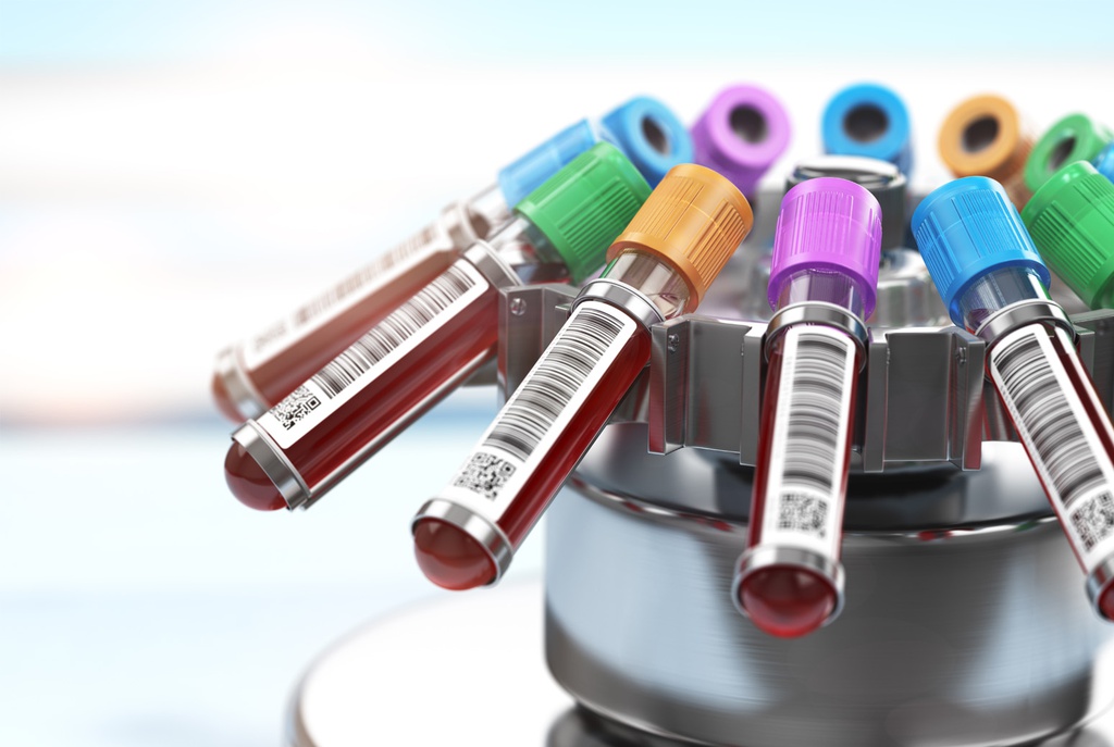 clinical laboratory blood test equipment