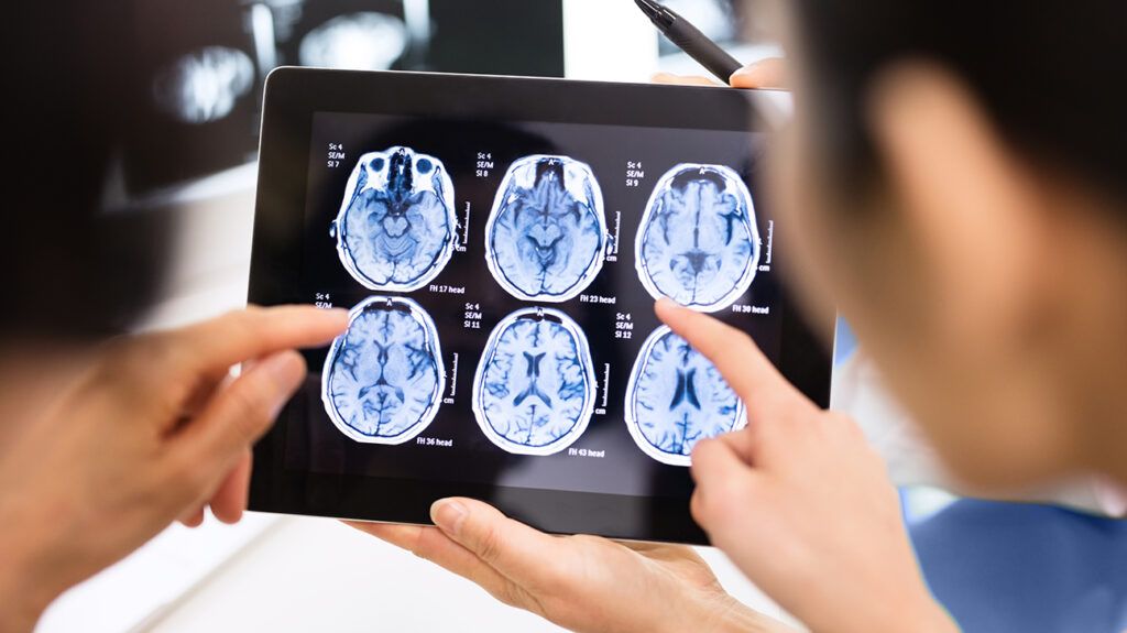 brain scan technology