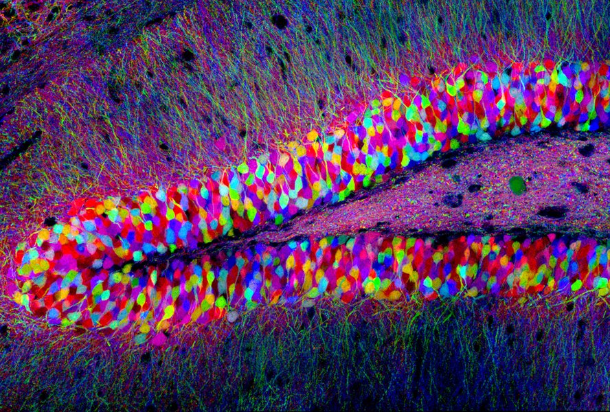 Brainbow 標記的小鼠海馬體神經元