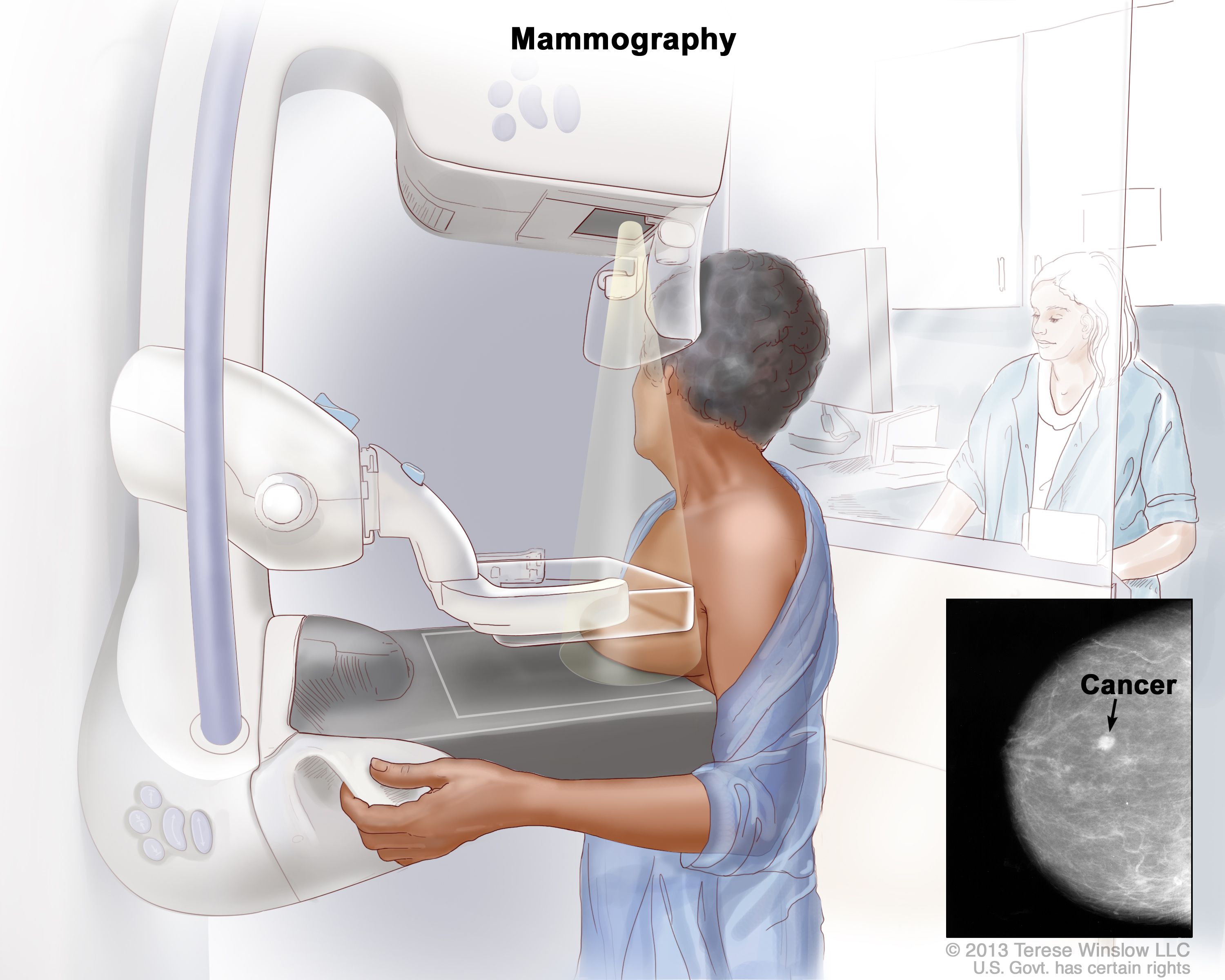 breast lesion diagnostic equipment