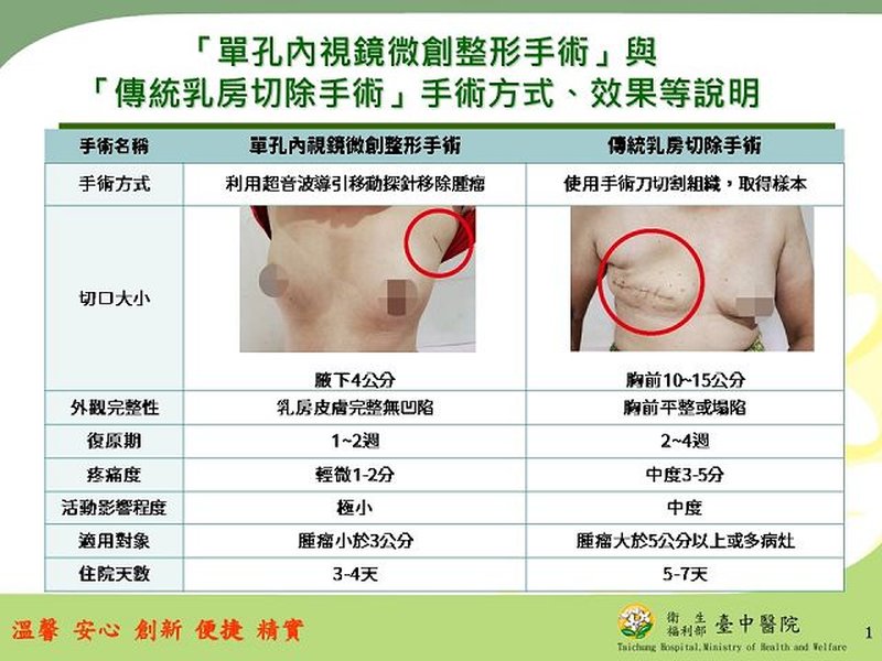 微創手術與傳統手術比較示意圖