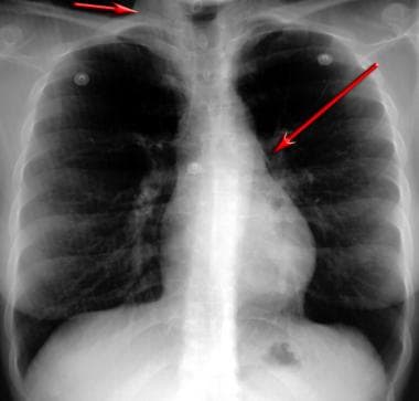 asthma breathing chest diagnostic