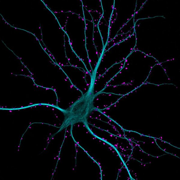 Hippocampal neuron receiving excitatory contacts (green) on dendrites