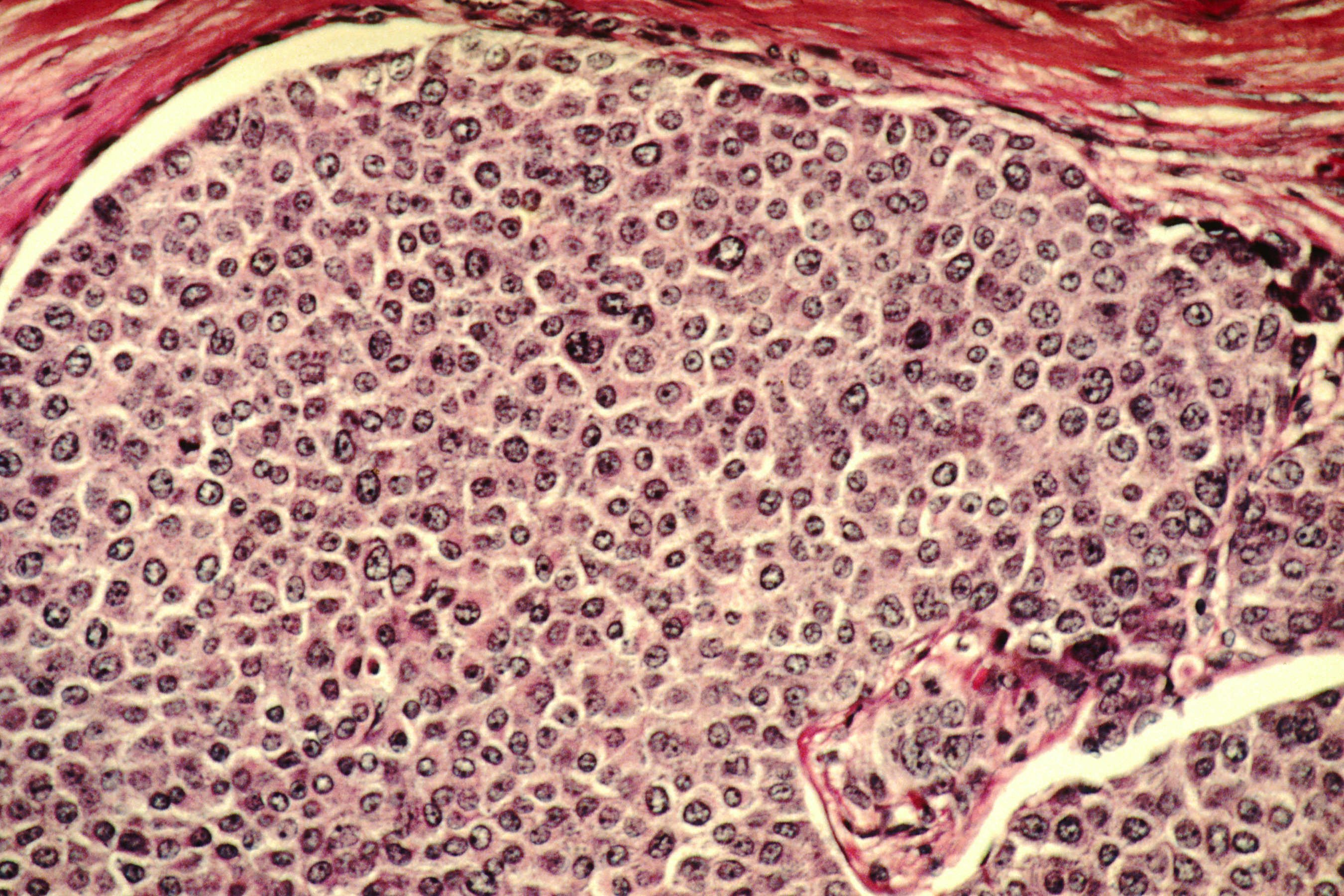 cancer cell and tissue microscopy