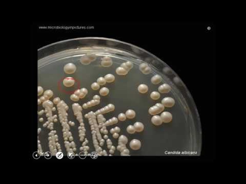clinical laboratory candida cultures