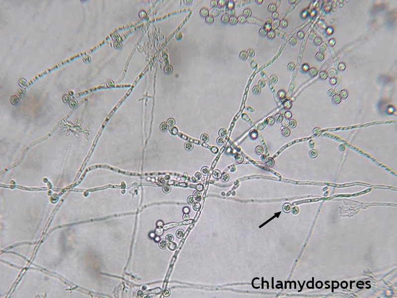 Candida albicans Chlamydospores