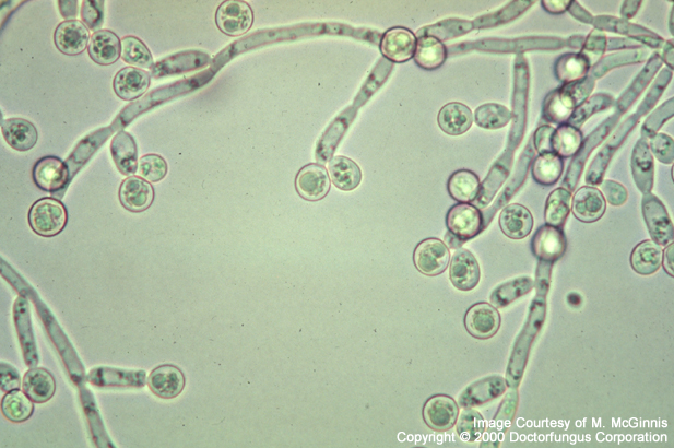 candida microscopy clinical images