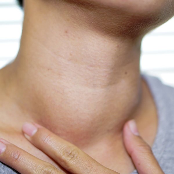 causes-goitre-thyroidien-dgr9hdw4