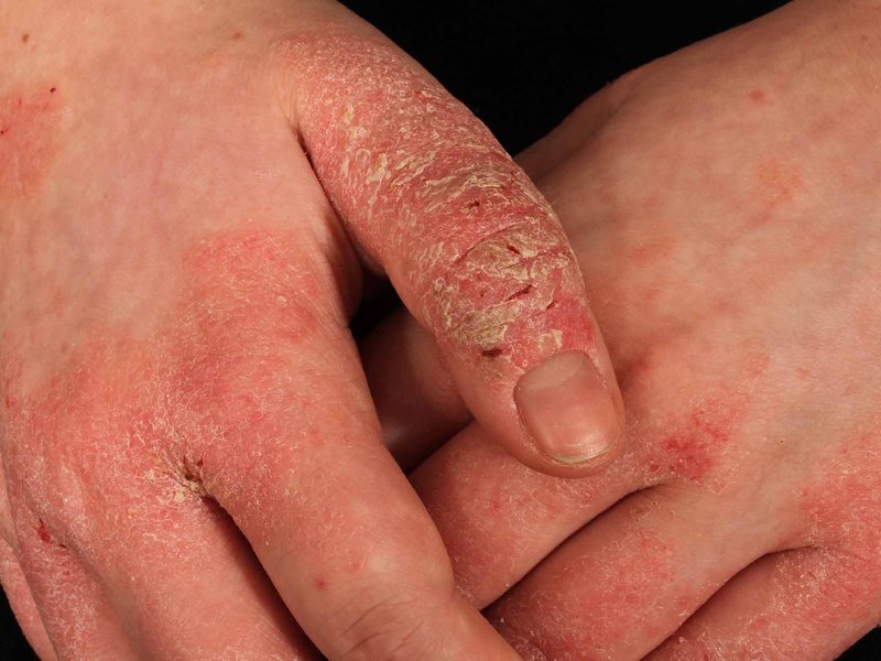 causes-itching-under-skin-xi5dy68a