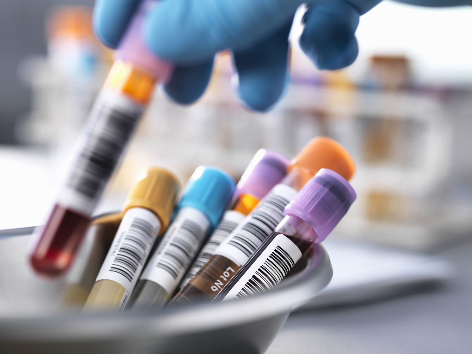 gluten containing foods and laboratory blood tests